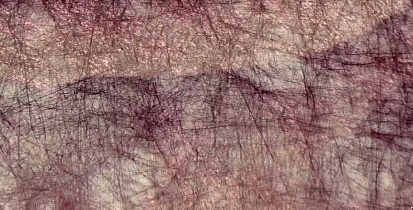 Vliesstoff, sog. Nagelfiber, 
- rechteckig zugeschnitten, mit den Abmessungen von 6,5 cm x 7 cm,
- laut Untersuchungsergebnis:
-- einlagiger Vliesstoff aus synthetischen Filamenten (Polyester),
-- mit Bindemittel verfestigt,
-- bedruckt,
-- mit einem Quadratmetergewicht von 20,5 Gramm,
-- weder bestrichen noch überzogen,
-- kein melt blown.

"Vliesstoff, aus synthetischen Filamenten, mit einem Quadratmetergewicht von weniger als 
25 g, weder bestrichen noch überzogen; anderer als in den Unterpositionen 5603 1190 10 
bis 5603 1190 20 genannter"