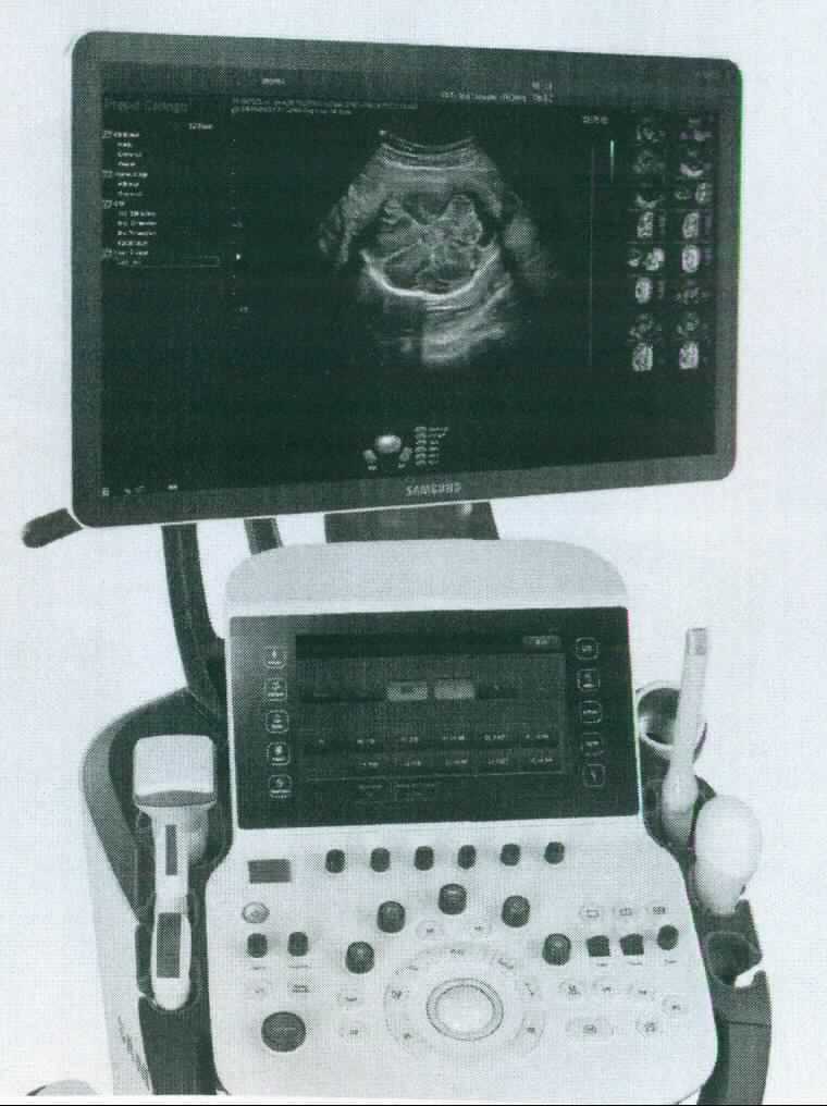 Samsung Ultraschalldiagnosegerät, Artikel-Nr. WS80A, in Form einer funktionellen Einheit zur medizinischen Ultraschalldiagnostik, im Wesentlichen bestehend aus einem Ultraschallprozessor zur Erstellung von Ultraschallbildern in der rollbaren Konsole des Geräts, verschiedenen über Kabel verbundenen Ultraschallköpfen (den Sonden zum Senden und Empfangen von Ultraschallwellen), einem Bedienpanel mit Knöpfen und Reglern, einer Tastatur und einem Touchscreen-Panel in einer schwenkbaren Halterung und einem oben am Gerät platzierten LCD-Bildschirm. Das Gerät wird von Gynäkologen zur fetalen, bzw. embryonalen Ultraschalldiagnostik und zur Mammasonographie (Ultraschalluntersuchung der Brust) verwendet.
Alle Bestandteile sind gemeinsam verpackt.
Zur äußeren Form siehe Abbildung in Anlage.

Die Ware wird als "medizinisches Ultraschalldiagnosegerät" eingereiht.