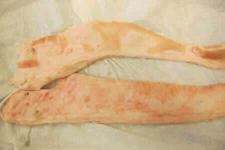 Antragsangaben:
Bei dem als "Schweinefett von der Brust" bezeichneten Erzeugnis soll es sich gemäß vorgelegter Schnittspezifikation um Tiefkühlgut (Temperatur < -18 °C) handeln.

Feststellungen anhand eines Warenmusters: 
Stücke aus weißem Fettgewebe, ohne Schwarte, nicht durchwachsen und lediglich partiell mit kleinen bzw. dünnen Anteilen von rötlichem Fleisch. Zum Teil ist Drüsengewebe erkennbar.

Befund:
Schweinespeck ohne magere Teile, Schweinefett und Geflügelfett, weder ausgeschmolzen noch anders ausgezogen, frisch, gekühlt, gefroren, gesalzen, in Salzlake, getrocknet oder geräuchert / - von Schweinen / -- Schweinespeck / --- frisch, gekühlt, gefroren, gesalzen oder in Salzlake