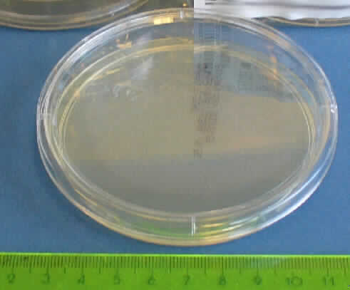 Agar-Fertigplatte

Angaben:
Bei der Ware soll es sich um Fertigplatten zur mikrobiologischen Diagnostik (z.B. zur Keimzahlbestimmung in Milch) handeln. Die sterilen Nährböden bestehen aus wasserhaltigem Caseinpepton-Agar mit Zusatz von Hefeextrakt und Glucose.

Feststellungen:
In einer etikettierten Folienverpackung befinden sich zehn runde, flache Kunststoffdosen mit Deckel (Durchmesser: ca. 9 cm), in die ein gelbliches, klares, ca. 1,5 mm starkes Gel gegossen ist.

Befund:   
Zubereitete Nährsubstrate zum Züchten und Erhalten von Mikroorganismen (einschließlich Viren und dergleichen) oder pflanzlichen, menschlichen oder tierischen Zellen

Nährsubstrate für Mikroorganismen werden vom Wortlaut der Position 3821 erfasst, selbst wenn sie in einer Aufmachung als Diagnostik- oder Laborreagenz vorliegen.