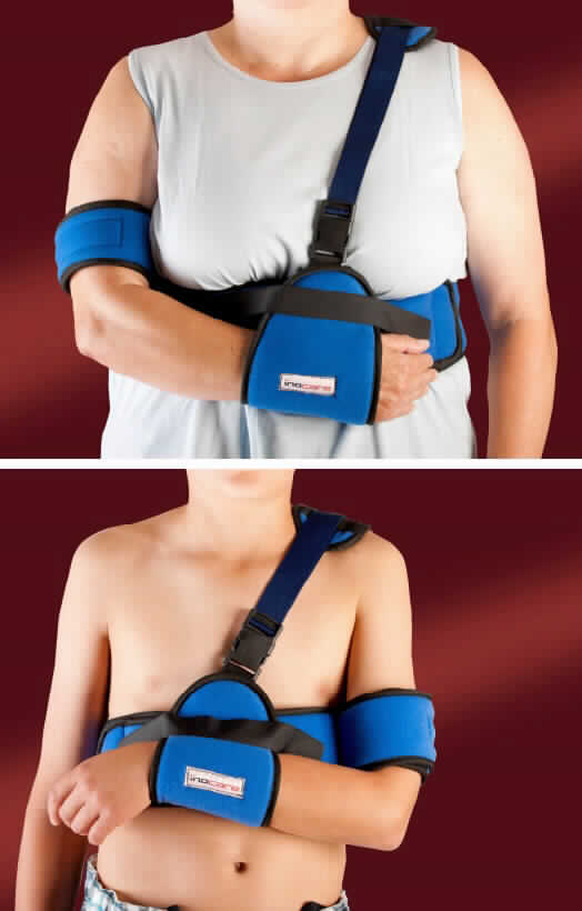 Schulter-Arm-Abduktionsorthese, sog. Deltacare plus, als Modell für Kinder und für Erwachsene, bestehend aus einem speziellen Gurtsystem aus einer ca. 13 cm breiten Armschlinge, einem gepolsterten Schultergurt, einem ca. 11 cm breiten Körpergurt sowie einem ca. 7 cm breiten Oberarmgurt, alles überwiegend aus Spinnstoff mit Schaumstoffpolsterung. Der Oberarmgurt wird um den unteren Bereich des Oberarms, die Armschlinge um das Handgelenk gelegt. Die Vorrichtung wird vor dem Oberkörper mit Hilfe von Klettverschlussbändern angelegt, wobei der Unterarm in angewinkelter Position in der Schlinge ruht und dort fixiert wird. 
Äußere Form: siehe Abbildungen in der Anlage.
Die Vorrichtung dient hauptsächlich zur Ruhigstellung der Schulter durch Fixierung des Arms am Oberkörper bei AC-Gelenkverletzungen, Weichteilreizzuständen im Schulterbereich, Muskel- und Sehnenverletzungen, Fraktur des Oberarms, Schulterblattfraktur, Luxation bzw. Luxationsbruch, subcapitaler Humerusfraktur, kalzifizierenden Rotatorenmanschetten sowie periartikulären Reizzuständen und Erkrankungen im Bereich des Glenohumeralgelenkes, kann aber auch bei Tendinitis der langen Bizeps-Sehne oder Bursitis acromialis eingesetzt werden.

Die Ware, welche mit einer Gebrauchsanweisung in einer Kunststofftüte und zusätzlich in einem Pappkarton verpackt ist, wird als "Vorrichtung zum Behandeln von Knochenbrüchen einschließlich Verrenkungen und Gelenkverletzungen" eingereiht.