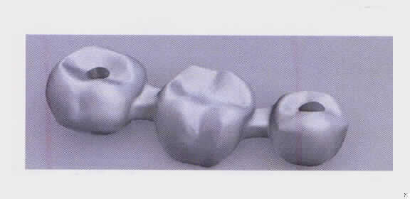 Sog. Brücke, in Form einer Warenzusammenstellung in Aufmachung für den Einzelverkauf, bestehend aus
1. einem unfertigen, patientenspezifischen Brückengerüst aus Cobalt Chrome (charakterbestimmender Bestandteil im Hinblick auf die Verwendung), in verschiedenen Ausführungen (z. B. dreigliedrig, viergliedrig usw.) - je nach Anzahl der Implantate auf denen die Brücke befestigt wird (mindestens zwei bis höchstens sechzehn) und
2. einer entsprechenden Anzahl an titanlegierten Schrauben (zwei bis sechzehn).
Äußere Form: siehe Anlage (Abbildung beispielhaft).
Das Brückengerüst wird nach gescannten, individuellen Patientendaten hergestellt. Die Ware wird durch einen Zahntechniker durch Auftragen von mehreren Schichten Verblendmaterial aus Kunststoff oder Porzellan sowie durch Glasieren und Auftragen von Farbstoff und ggf. durch Polieren fertiggestellt. Die fertige Brücke wird in den Mund des Patienten eingesetzt und auf Implantate (ebenfalls nicht Gegenstand dieser vZTA) aufgeschraubt. Sie dient als dauerhafter, künstlicher Zahnersatz für fehlende natürliche Zähne im menschlichen Gebiss.

Die Ware wird als "künstliches Körperteil in Form einer anderen Ware der Zahnprothetik für Menschen, keine Ware der Unterpositionen ((KN) 9021 2110 bis 9021 2190" eingereiht.