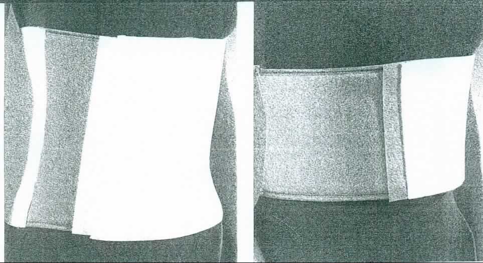 Bauch-/Rippenstützgürtel, sog. Universal Abdominalbandage, Universal Rippenbandage, Fotos siehe Anlage,
- in einem Pappkarton verpackt,
- aus Spinnstoffen; mit einem Mittelteil und einem Seitenteil aus ca. 1,4 mm dicken, einfarbigen, elastischen 
  Gewirken sowie mit einem Seitenteil aus einem einseitig (Innenseite) mit einer Lage aus Zellkunststoff
  versehenen Gewirke der Position 5903; das Gewirke ist dicht, geraut und bildet die Außenseite und dient
  damit nicht nur der Verstärkung des Zellkunststoffs,
- wird unterhalb des Brustkorbs um den Leib gelegt und in der Art einer Stützbandage getragen; in den 
  Abmessungen: ca. 106 cm lang und ca. 25,5 cm breit,
- seitlich und im Bereich der Vorderseite mit insgesamt drei entnehmbar in Taschen gelagerten, schmalen, 
  flexiblen Federstäbchen aus Kunststoff, die lediglich ein Aufrollen der Bandage verhindern,
- vor dem Bauch mit aufgenähtem Klettverschluss zu schließen (u. a. damit konfektioniert), 
- an den Rändern teilweise mit schmalen Gewebebändern eingefasst,
- dient laut Antrag der Stützung und Kompression bei Zerrung und Überdehnung im Abdominalbereich, 
- weist keine individuelle Anpassung an den spezifischen Funktionsschaden des Patienten auf; nach der 
  Materialbeschaffenheit, dem Verwendungszweck und der Ausstattung (keine herausnehmbare bzw. fest 
  eingearbeitete, steife, anatomische Stützen) handelt es sich nicht um eine orthopädische Vorrichtung der 
  Position 9021, da die Bandage orthopädisch weder eine ausreichende Stütz- und Haltefunktion nach einer 
  Krankheit, Operation oder Verletzung besitzt noch der Verhütung oder Korrektur körperlicher Fehlbildungen 
  dient; es liegt ein einfacher Gürtel zur Stützung des Körpers vor.

"Den Hüftgürteln ähnliche Ware (Bauch-/Rippenstützgürtel) aus Gewirken"