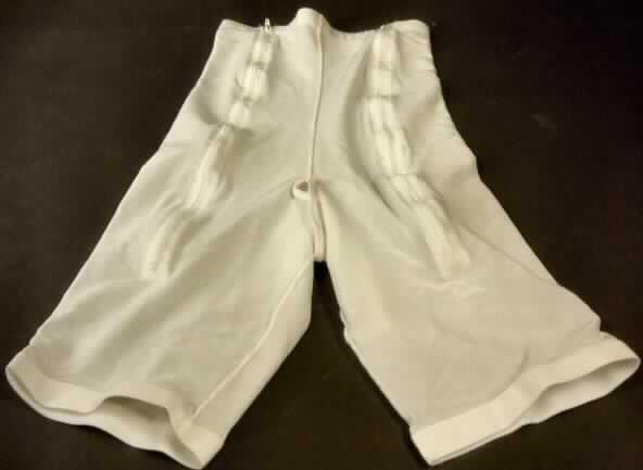 Miederhose, sog. Kompressionshose, Größe L, Foto siehe Anlage,
- in einer Pappschachtel für den Einzelverkauf aufgemacht,
- aus 0,5 mm dicken, einfarbigen, elastischen Gewirken aus laut Antrag 75% Nylon und
  25% Elasthan (beides Chemiefasern),
- als klassische, lange Miederhose gearbeitet, über die Taille nach oben bis unter die Brust   
  reichend (Seitenlänge: etwa 65 cm),
- vorn mit zwei, vom oberen Rand bis unter den Schritt reichenden Öffnungen; jeweils mit 
  Hakenverschluss und darüber liegendem Reißverschluss,
- mit offenem Schritt,
- mit elastischen Beinabschlüssen,
- soll der Kompression nach einer Liposuktion bzw. der Stützung nach Unterleibs-, Gesäß-, 
  Lenden- oder Oberschenkeloperationen dienen und stellt sich nach Schnitt, Ausstattung
  und Materialbeschaffenheit als Miederhose der Position 6212 dar,
- keine orthopädische Vorrichtung des Kapitels 90, da sich die Stützwirkung ausschließlich 
  aus der Elastizität der Gewirke herleitet.

"Den Hüftgürteln ähnliche Ware, aus Gewirken, Miederhose"