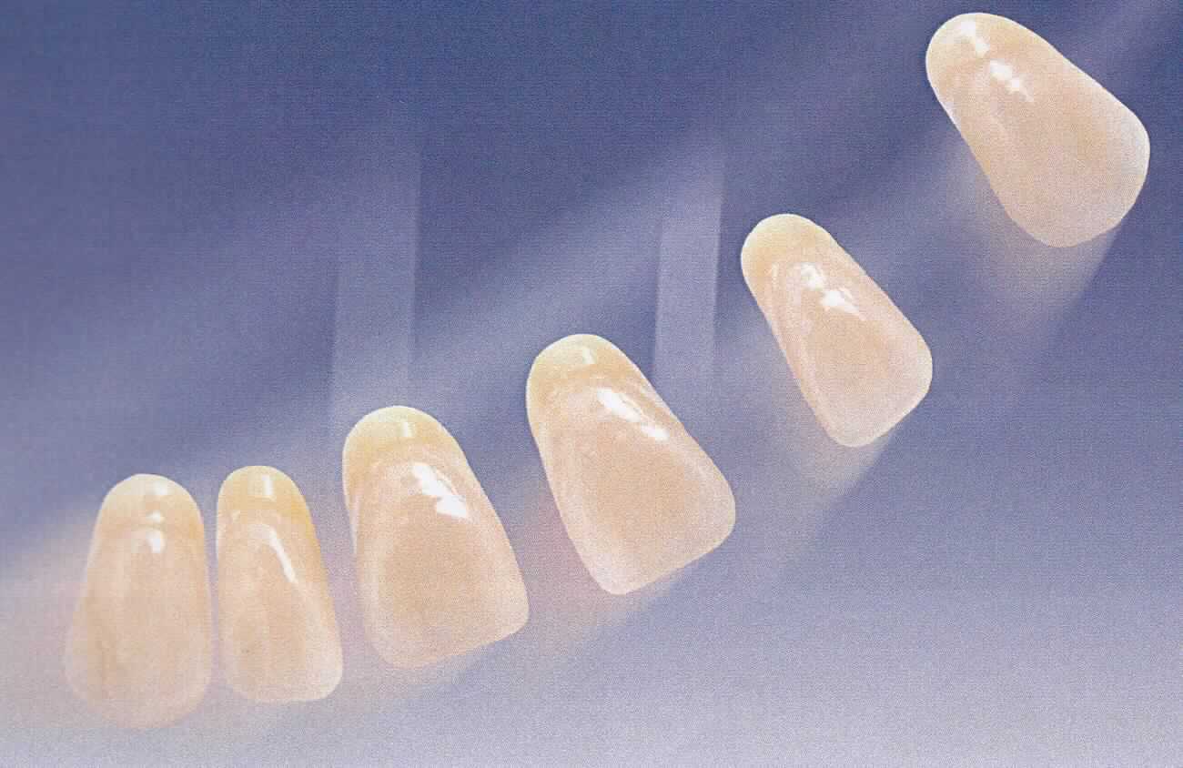 Sog. Inka-Teeth Kunststoffzähne, in Form von künstlichen Front- oder Seitenzähnen aus Polymethylmethacrylat (PMMA) in Verbindung mit strukturvernetzenden Zusätzen. Die einzelnen Inka-Kunststoffzähne werden in verschiedenen Farben und Größen in Teilprothesen, Vollprothesen und Interimsprothesen (nicht Gegenstand dieser Auskunft) eingesetzt und dienen  dem Ersatz der natürlichen Zähne von Menschen (beispielhafte Abbildung in der Anlage).

Die Waren werden als "künstliche Körperteile in Form von künstlichen Zähnen aus Kunststoffen für Menschen" eingereiht.