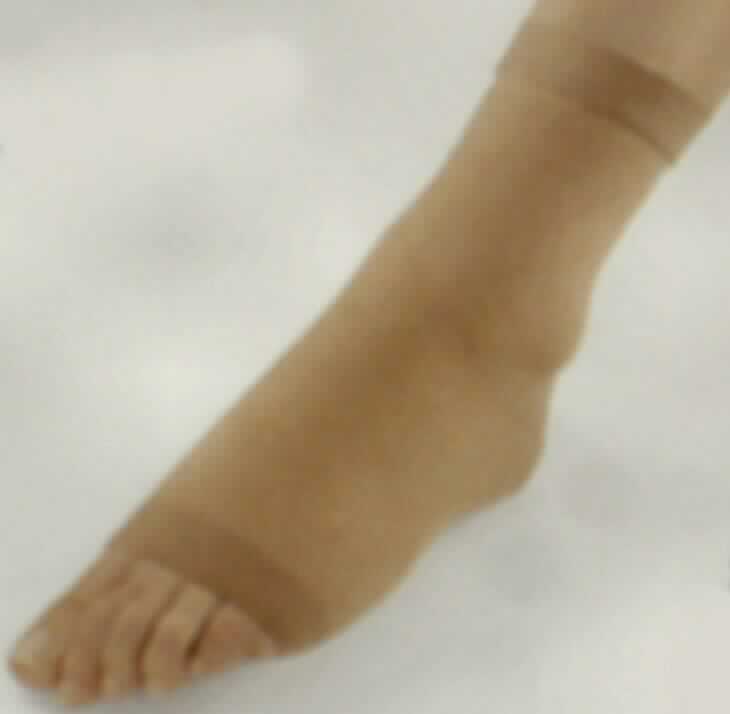 Sprunggelenkbandage, sog. Dynamics Knöchelsocke Classic, Art. 44 8410, Größe 1, Foto siehe Anlage,
- schlauchförmig, anatomisch dem Sprunggelenk angepasst, abgepasst gewirkt; den Knöchel und den Fuß mit 
  Ausnahme der Zehen umhüllend; flachliegend mit einem oberen Durchmesser von ca. 8,5 cm, einem unteren 
  Durchmesser von ca. 7 cm und einer Länge von ca. 21 cm,
- aus ca. 1,1 mm dicken, elastischen, einfarbigen Gewirken aus Spinnstoffen,
- am oberen Rand mit einem doppelt gearbeiteten, innen angenähten Bund (damit konfektioniert), am unteren 
  Rand abgepasst hergestellt,
- dient lt. Antrag der Stabilisierung des Sprunggelenks, u. a. bei chronischer Bänderschwäche, Sehnenreizungen,
  Prellungen und Verstauchungen,
- stellt sich aufgrund der Verwendung nicht als Strumpfware oder als anderes Bekleidungszubehör dar, 
- nach der Materialbeschaffenheit und der Ausstattung handelt es sich nicht um eine orthopädische Vorrichtung,
  da sich die Stützfunktion ausschließlich aus der Elastizität der Spinnstoffe herleitet.

"Andere konfektionierte Ware (Sprunggelenkbandage) aus Spinnstoffen, aus Gewirken"