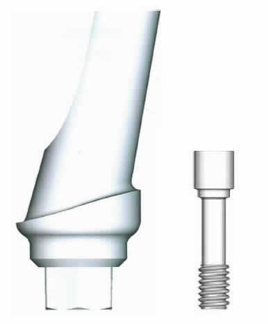 Abutment (künstlicher Zahnstumpf/Implantataufbau), sog. Contour-Abutment, abgewinkelt, für Plattform 3,5 mm (TRI-Vent-Implantate), mit TRI-Friction, Art.-Nr. TV20-41-F, in Form einer Warenzusammenstellung in Aufmachung für den Einzelverkauf, bestehend aus einem zylindrischen, konischen, abgewinkelten (17°) Abutment aus einer Titanlegierung mit internem Sechskant und einem Durchmesser (Austrittsprofil) von 4,5 mm (charakterbestimmender Bestandteil im Hinblick auf die Verwendung) für eine zementierte Restauration sowie einer Halteschraube aus Titan Grad 5 (Art.-Nr. RS-TV10).
Äußere Form: siehe Abbildung in der Anlage.
Das Abutment wird mit Hilfe der Schraube auf ein künstliches Zahnwurzelimplantat (nicht Gegenstand dieser Auskunft) geschraubt und dient so der Befestigung im Kiefer des Menschen. Anschließend wird der Aufbau mit der endgültigen Versorgung (ebenfalls nicht Gegenstand dieser Auskunft) versehen.
Die Bestandteile der Warenzusammenstellung sind gemeinsam in einer Blisterverpackung untergebracht.

Die Ware wird als "Teil, erkennbar hauptsächlich für eine Ware der Zahnprothetik der Position 9021 2900 bestimmt" eingereiht.