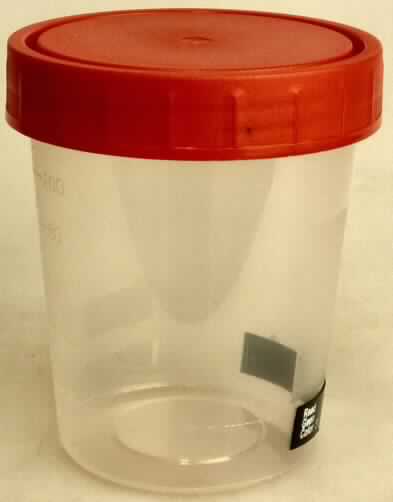 Angaben:
Medizinische Tests, Urinteststreifen zum Nachweis von 11 verschiedenen Parametern.

Feststellungen:
In einem u. a. mit der Aufschrift "Urinteststreifen" beschriftenen Pappkarton befindet sich eine runde Plastikdose mit 100 Teststreifen. Auf jedem Teststreifen befinden sich 11 Felder mit chemischen und enzymatischen Nachweisreagenzien zum Nachweis von u. a. Glucose, Bilirubin, Keton u.a. in Urin. Die Felder verfärben sich bei einer positiven Reaktion. Das Testergebnis erhält man durch direkten Farbvergleich der Testfelder mit der farbigen Abbildung auf der Dose.

Befund:
Zubereitete Diagnostikreagenzien, auch auf einem Träger.
