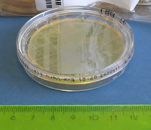CASO-Abklatschplatte

Angaben:
Bei der Ware soll es sich um Fertigplatten zur mikrobiologischen Diagnostik (z.B. zur Keimzahlbestimmung auf Oberflächen durch Abklatschtest) handeln. Das sterilisierte Fertignährmedium besteht aus wasserhaltigem Casein-Sojapepton-Agar mit Natriumchlorid und Zusatz von Tween 80 und Lecithin.

Feststellungen:
In einer etikettierten 3-fach-Folienverpackung befinden sich zehn runde, flache Kunststoffdosen mit Deckel (Durchmesser: 6 cm), in die ein gelbliches, klares, ca. 5 mm starkes Gel gegossen ist. Deckel und Gel weisen ein Raster auf.

Befund:   
Zubereitete Nährsubstrate zum Züchten und Erhalten von Mikroorganismen (einschließlich Viren und dergleichen) oder pflanzlichen, menschlichen oder tierischen Zellen

Nährsubstrate für Mikroorganismen werden vom Wortlaut der Position 3821 erfasst, selbst wenn sie in einer Aufmachung als Diagnostik- oder Laborreagenz vorliegen.
