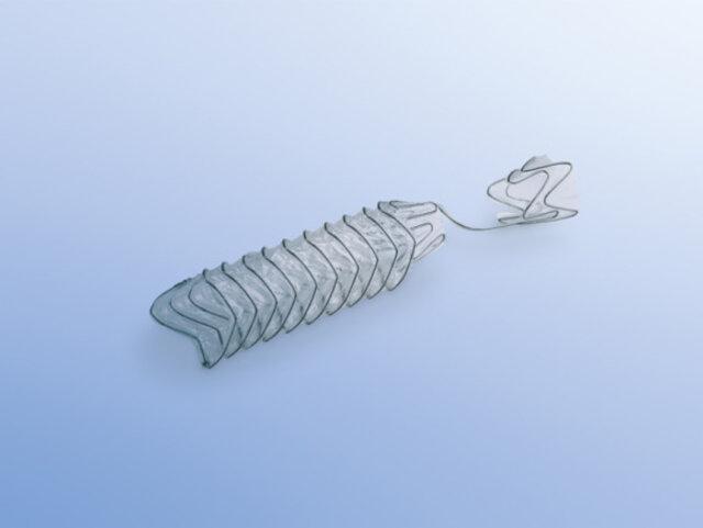 Sog. TPS Stent, in Form einer Warenzusammenstellung in Aufmachung für den Einzelverkauf, im Wesentlichen bestehend aus:

1. einem selbstexpandierenden, röhrenförmigen Stent (charakterbestimmend im Hinblick auf die Verwendung) aus einem Nitinol-Metallgeflecht, beschichtet mit einem nicht resorbierbaren CO-Polymer (verhindert ein Einwachsen in das Gewebe), in vier
verschiedenen Längen (30, 40, 50 bzw. 60 mm) und
2. einem Messkatheter.

Zur äußeren Form siehe Abbildung in der Anlage.

Der Stent wird mithilfe eines Einführsystems (nicht Gegenstand dieser vZTA-Entscheidung) dauerhaft in den menschlichen Körper implantiert, wo er selbstständig expandiert und eine Verengung überbrückt. Er wird bei Obstruktionen im urologischen Bereich (z. B. Prostata-Verengungen) verwendet.

Die Ware wird als "Vorrichtung zum Implantieren in den menschlichen Körper, zum Beheben eines Funktionsschadens, nicht von den Unterpositionen (KN) 9021 1010 bis 9021 9010 erfasst" eingereiht.