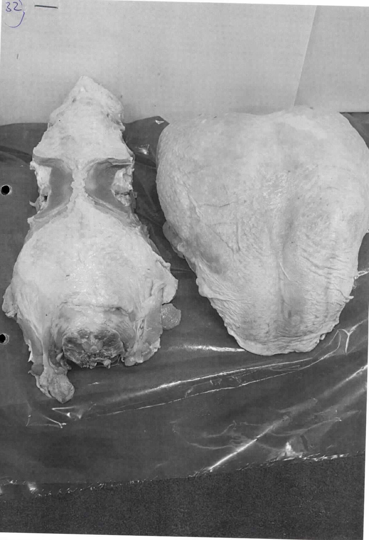Nach den Antragsangaben, den ergänzenden Angaben und der vorliegenden Warenprobe handelt es sich um eine sogenannte gefrorene halbe Putenbrust mit Flügel sowie Haut und Knochen wie gewachsen, bei denen ein Teil der Knochen (Rippen) entfernt wurden. Das Teilstück weist kein Rückenteil und keinen Schenkel auf.

Bei den Teilstücken liegen keine "Brüste" im Sinne der Zusätzlichen Anmerkung 4) a) und e) zu Kapitel 2 vor.

Zolltarifrechtlich handelt es um "gefrorene Teile von Truthühnern mit Knochen, andere als in den Unterpositionen (KN) 0207 2720 bis 0207 2760 genannt".