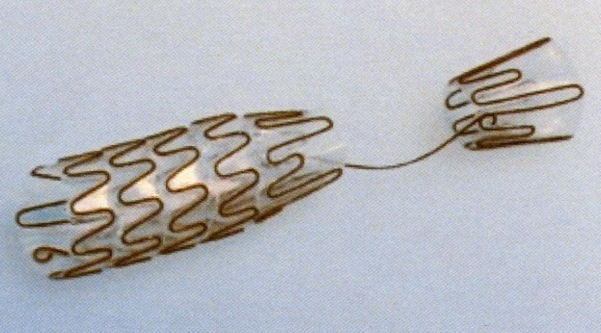 Sog. Stent, Art.-Nr. 2540020030, 2540020040, im Wesentlichen bestehend aus einem selbstexpandierenden, röhrenförmigen Stent aus einem Nitinol-Metallgeflecht, beschichtet mit einem nicht resorbierbaren CO-Polymer (verhindert ein Einwachsen in das Gewebe), mit Verankerungssegment und einer Gesamtlänge von entweder 30 oder 40 mm.

Zur äußeren Form siehe Abbildung in der Anlage

Der Stent wird mit Hilfe eines Einführsystems (nicht Gegenstand dieser vZTA-Entscheidung) dauerhaft in den menschlichen Körper implantiert, wo er selbstständig expandiert und eine Verengung überbrückt. Er wird bei Obstruktionen im urologischen Bereich (z. B. Blasenhalsstenosen) verwendet.

Die Ware wird als "Vorrichtung zum Implantieren in den menschlichen Körper, zum Beheben eines Funktionsschadens, nicht von den Unterpositionen (KN) 9021 1010 bis 9021 9010 erfasst" eingereiht.