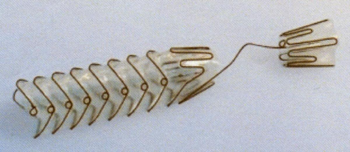 Sog. TPS Stent (Art.-Nr. 2540010030, 2540010040, 2540010050, 2540010060), in Form einer Warenzusammenstellung in Aufmachung für den Einzelverkauf, im Wesentlichen bestehend aus:

1. einem selbstexpandierenden, röhrenförmigen Stent (charakterbestimmend im Hinblick auf
die Verwendung) aus einem Nitinol-Metallgeflecht, beschichtet mit einem nicht
resorbierbaren CO-Polymer (verhindert ein Einwachsen in das Gewebe), in vier
verschiedenen Längen (30, 40, 50 bzw. 60 mm) und
2. einem Messkatheter.

Zur äußeren Form siehe Abbildung in der Anlage.

Der Stent wird mithilfe eines Einführsystems (nicht Gegenstand dieser vZTA-Entscheidung) dauerhaft in den menschlichen Körper implantiert, wo er selbstständig expandiert und eine Verengung überbrückt. Er wird bei Obstruktionen im urologischen Bereich (z. B. Prostata-Verengungen) verwendet.

Die Ware wird als "Vorrichtung zum Implantieren in den menschlichen Körper, zum Beheben eines Funktionsschadens, nicht von den Unterpositionen (KN) 9021 1010 bis 9021 9010 erfasst" eingereiht.
