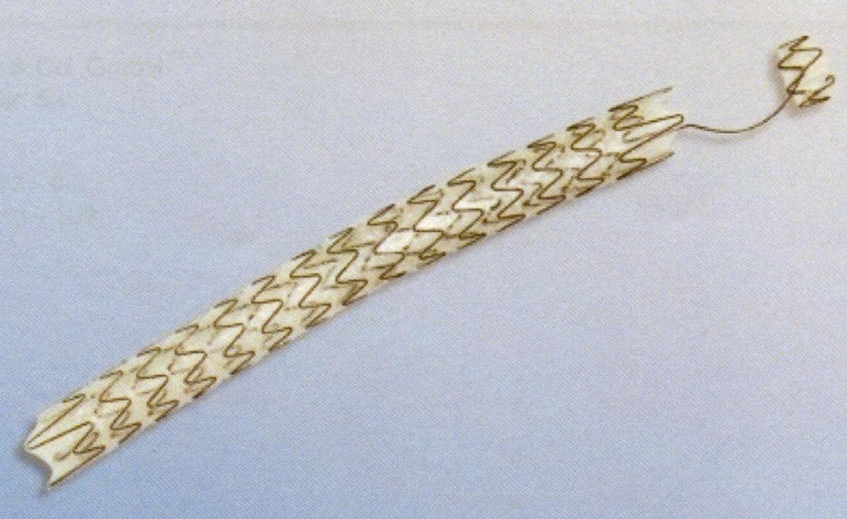 Sog. URS Stent, im Wesentlichen bestehend aus einem selbstexpandierenden, röhrenförmigen Stent aus einem Nitinol-Metallgeflecht, beschichtet mit einem nichtresorbierbaren CO-Polymer (verhindert ein Einwachsen in das Gewebe), je nach Ausführung mit einem Durchmesser von 8 bzw. 10 mm und einer Länge von 100 bzw. 120 mm.

Zur äußeren Form siehe Abbildung in der Anlage.

Der Stent wird mithilfe des Applikationssystems (nicht Gegenstand dieser vZTA-Entscheidung) dauerhaft in den menschlichen Körper implantiert, wo er selbstständig expandiert und eine Verengung überbrückt. Er wird bei Obstruktionen im urologischen Bereich (z. B. chronischen Ureterstrikturen) verwendet.

Die Ware wird als "Vorrichtung zum Implantieren in den menschlichen Körper, zum Beheben eines Funktionsschadens, nicht von den Unterpositionen (KN) 9021 1010 bis 9021 9010 erfasst" eingereiht.