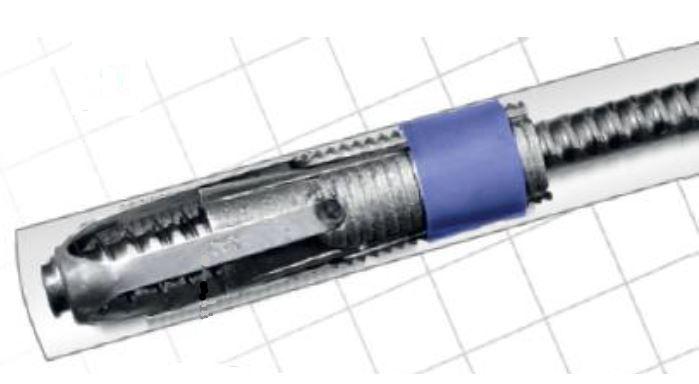 Es handelt sich um mehrteilige Erzeugnisse aus Stahl, bestehend aus einem kreizylindischen, konisch zulaufenden Kern, mit Innengewinde, der von drei halbrund gebogenen und mit außenseitiger Rippung versehenen sogenannten Lamellen umhüllt ist, einem dreiarmigen, federgelagerten Endstück, das die Lamellen fixiert, sowie einer Manschette aus Kunststoff. Die Erzeugnisse werden beim Berg- und Tunnelbau als Komponente in einem Gebirgsanker verbaut und zur mechanischen Verankerung im Gebirge verwendet.
- Antragstellerangaben -
Bei den aus verschiedenen Stoffen zusammengesetzten Erzeugnissen bestimmt der Stahl aufgrund des Umfangs und in Bezug auf die Bedeutung für die Verwendung den Charakter des Ganzen.

Abbildung siehe Anlage.

Derartige Erzeugnisse gehören als "Konstruktionsteile (Gerüst,- Schalungs- oder Stützmaterial), aus Stahl" zum TARIC-Code 7308 4000 00.