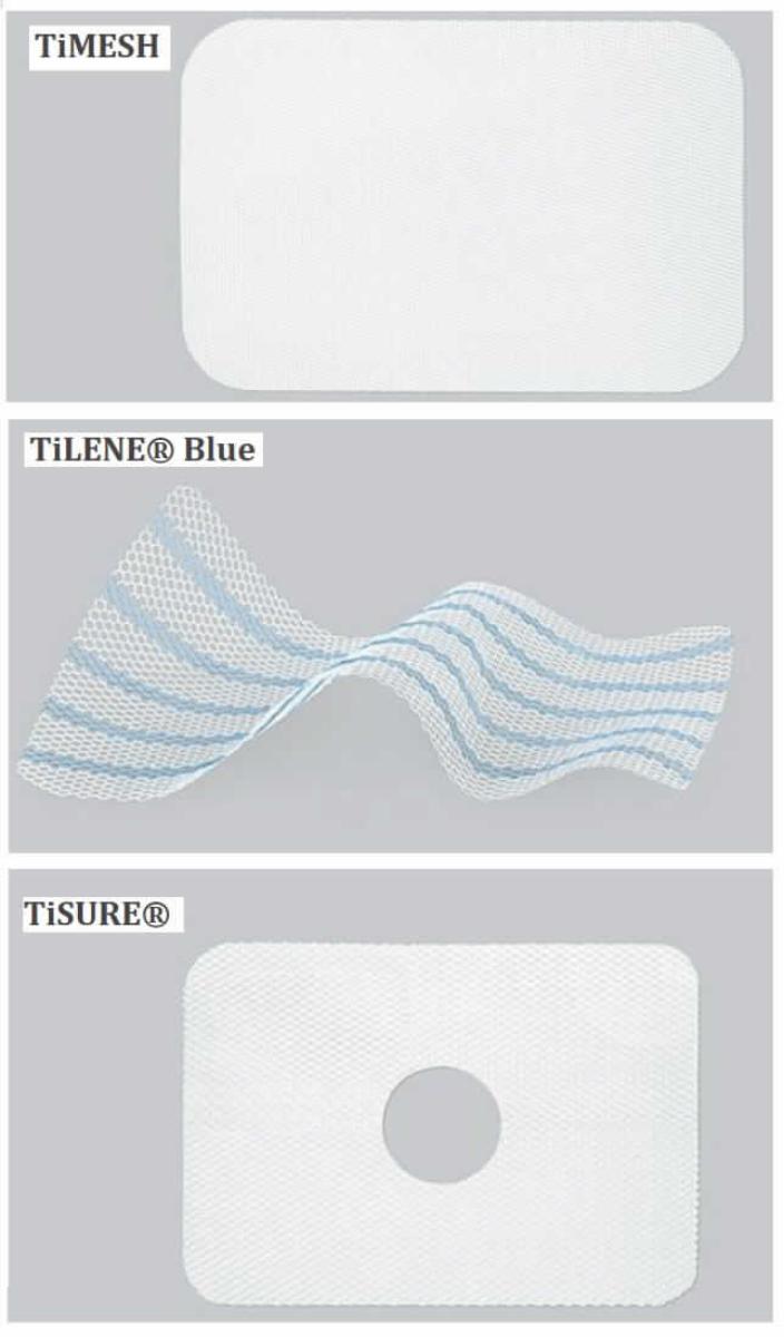 Titanisierte Herniennetze, in verschiedenen Konfigurationen, sog. TiMESH, TiLENE Blue und TiSURE, jeweils im Wesentlichen bestehend aus einem rechteckig in verschiedenen Größen zugeschnittenen, nicht resorbierbaren, flexiblen, elastischen Polypropylennetz aus monofilem, makroporösen Gewirke mit hydrophiler, durch Titanisierung entstandener Beschichtung und atraumatischem Netzrand. Das TiLENE Blue-Netzimplantat weist zudem blaue Markierungsstreifen zur Erleichterung der Positionierung auf. Das TiSURE-Netzimplantat ist mehrlagig und weist in der Mitte ein Loch mit einem Durchmesser von 22 mm auf. Das Flächengewicht des Netzes beträgt für TiMESH 16, 35, bzw. 65 g/m², für TiLENE Blue 24 g/m² und für TiSURE 35 bzw. 65 g/m².
Äußere Form: siehe Abbildung in der Anlage.
Die Netzimplantate werden durch einen Chirurgen zur Leistenbruchbehandlung bei intra- und extraperitonealen Hernien im Rahmen der Hernienchirurgie (TiMESH, TiLENE Blue) bzw. zur Verstärkung des Zwerchfells bei bestehenden Defekten im Bereich der Durchtrittspforte des Ösophagus (TiSURE) dauerhaft in den Körper des Patienten eingebracht.

Die jeweils steril verpackte Ware wird als "Vorrichtung zum Implantieren in den menschlichen Körper, zum Beheben eines  Funktionsschadens, nicht von Unterposition KN 9021 1010 bis 9021 9010 erfasst" eingereiht.