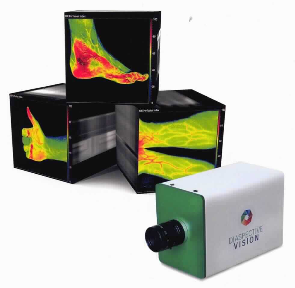 Sog. Tissue Kamerasystem, als kombinierte Maschine aus einem optische Strahlen verwendenden Untersuchungsgerät und einem PC, im Wesentlichen bestehend aus:
- einer Hyperspektralkamera,
- einer Beleuchtungseinheit aus Halogenstrahlern bestehend sowie
- einem Rollwagen, in welchen ein PC-System einschließlich der Eingabeelemente sowie ein Bildschirm integriert sind.
Die Kamera befindet sich in einem quaderförmigen Gehäuse mit den Abmessungen von 145 x 84 x 107 mm. Sie ist mit einem CMOS-Sensor ausgestattet und erfasst den Spektralbereich von 500 bis 1.000 nm. 
Die Beleuchtungseinheit wird durch einen quadratischen und flachen Körper gebildet, der einerseits die Strahler und andererseits die Kamera mittig in sich aufnimmt. Beide Systemteile sind an einem Schwenkarm mit Kugelkopf angebracht.
Der Wagen stellt eine auf 4 kreuzförmig angeordneten Rollen gelagerte säulenartige Konstruktion dar, die die Abmessungen von ca. 56 x 150 x 73 cm aufweist. Im mittleren Bereich der Säule befindet sich ein Tisch für die Tastatur und die Maus. Darüber ist das Fach, in welches der Computer integriert wurde, angebracht. Der Bildschirm sowie der Schwenkarm befinden sich oberhalb des Fachs am oberen Ende der Säule. Die Konstruktion ist mit einem System zur Höhenverstellung ausgestattet (äußere Form siehe Abbildung in der Anlage).
Das PC-System ist Windows-basiert. Die spezifische Anwendersoftware ist installiert. Der Monitor ist als LCD mit HD-Auflösung ausgeführt. Alle Komponenten sind durch mitgelieferte Kabel verbunden (funktionelle Einheit).
Die Ware basiert auf dem Prinzip der bildgebenden Spektroskopie. Sie erfasst das vom Untersuchungsobjekt reflektierte Licht, ermittelt anhand der aufgenommenen Wellenlängen dessen chemische Zusammensetzung und generiert ein Bild unter Nutzung mathematischer Algorithmen zur Gewinnung von Gewebeinformationen. Weiterhin werden Informationen über tiefere Gewebeschichten gewonnen, die Aussagen u. a. zu deren Wasser- und Fettgehalt ermöglichen.
Die Ware ist für die kontakt- und strahlungsfreie Aufnahme und bildhafte Darstellung chemischer Informationen im Bereich der Gewebeanalyse bestimmt und dient somit zur Diagnostik verschiedener Erkrankungen (kennzeichnende Hauptfunktion).
Die Ware wird als "anderes als in den Unterpositionen (KN) 9018 1100 bis 9018 1910 genanntes medizinisches Elektrodiagnosegerät" eingereiht