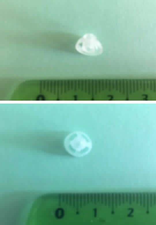 Hörgeräte-Schirmchen, sog. UniTip Open Dome, im Wesentlichen bestehend aus einem transparenten, runden, kuppelartig und anatomisch spezifisch geformten Erzeugnis aus Kunststoff (Elastomer / Fluor-Silikon) mit einem Außendurchmesser von 7 mm. Die Kuppel besteht aus vier sich mittig treffenden Stegen, auf der Innenseite befindet sich die Anschlussvorrichtung für den Gewindeanschluss des Schallschlauchs (nicht Gegenstand dieser vZTA-Entscheidung).
Äußere Form: siehe Abbildungen in der Anlage.
Der Dome wird an einen Schallschlauch eines Hörgerätes (ebenfalls nicht Gegenstand dieser vZTA-Entscheidung) angeschlossen und dient der Fixierung und Positionierung des Hörgerätes im Ohr sowie der Sicherung des Schallschlauches im Gehörgang und überträgt die Schallwellen an das Trommelfell.
10 Stück sind in einer Blisterpackung untergebracht.

Die Ware wird als "Teil für ein Schwerhörigengerät" eingereiht.