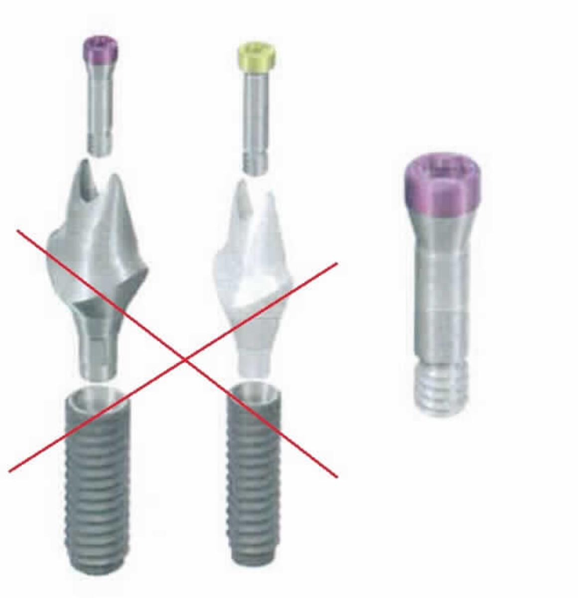 Sog. Basisschraube, REF: 025.0030, im Wesentlichen bestehend aus einer medizinischen Implantatschraube aus einer Titanlegierung mit einem kegelstumpfförmigen Kopf mit Innensechskant. Der Schaft ist mit einem kurzen, nicht bis zum Kopf reichenden, metrischen Gewinde versehen und am unteren Ende abgestumpft. 
Äußere Form: siehe Abbildung in der Anlage.
Die Basisschraube dient der Befestigung und dauerhaften Verbindung eines Sekundärteils (z.B. sog. Abutment) auf einem Zahnwurzelimplantat (jeweils nicht Gegenstand dieser vZTA-Entscheidung) im Rahmen einer zahnmedizinischen Behandlung.

Die Ware wird als "Teil, erkennbar hauptsächlich für eine Ware der Zahnprothetik bestimmt" eingereiht.