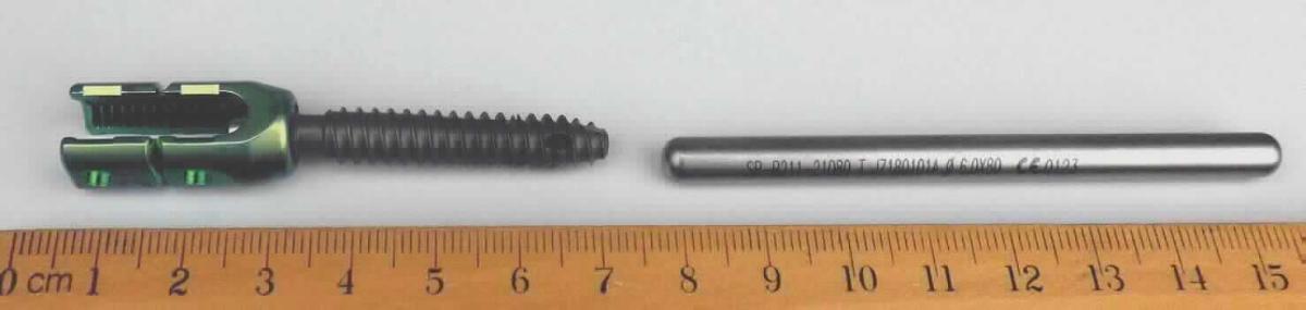 Wirbelsäulenimplantatsystem, in Form einer noch nicht zusammengesetzten Ware, im Wesentlichen bestehend aus mono- und polyaxialen Pedikelschrauben mit reduzierbaren Verlängerungen, Verschlussschrauben sowie geraden oder gebogenen Stäben in verschiedenen Ausführungen und Größen (äußere Form siehe Abbildung in der Anlage).
Das aus einer Titanlegierung bestehende System wird patienten- und indikationsspezifisch zusammengestellt und zur Stabilisierung der thorako-lumbalen Wirbelsäule (Th9 bis S1) bei verschiedenen Indikationen wie degenerativen Bandscheibenerkrankungen, Spondylolisthese, Pseudoarthrose, Tumor, Stenose, Derformitäten (Skoliose, Kyphose, Lordose), Osteoporose, erfolgloser Versteifung in der Vorgeschichte sowie zur Behandlung von Traumata (Fraktur oder Dislokation) in den menschlichen Körper implantiert. Es handelt sich somit um einen Multifunktionsapparat, dessen Haupttätigkeit (Hauptfunktion) nicht ermittelt werden kann. Die Einreihung erfolgt gemäß AV 3 c) in die letztgenannte der gleichermaßen in Betracht kommenden Unterpositionen.
Unter der Voraussetzung, dass im maßgebenden Zeitpunkt der Einfuhr erkennbar ist, dass es sich um ein oder mehrere patientenspezifische Sets handelt, wird die Ware wird als "Vorrichtung zum Behandeln von Knochenbrüchen" eingereiht.