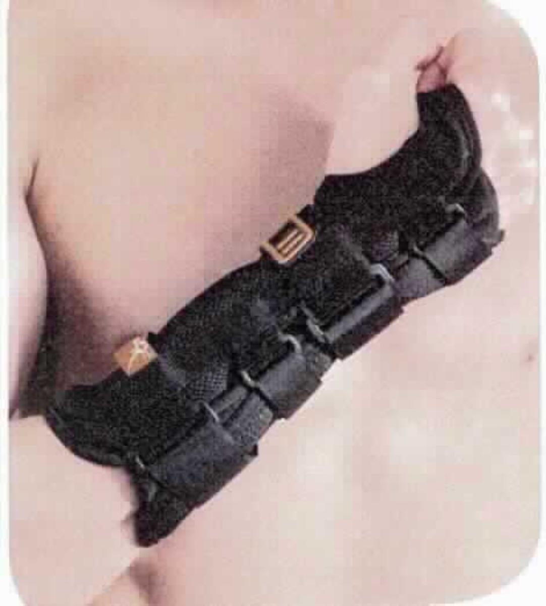 Sog. lange Handgelenkorthese, in vier verschiedenen Größen (S bis XL), in Form einer ca. 26 cm langen, zur Aufnahme des Handgelenks anatomisch geformten Vorrichtung aus Spinnstoff mit Daumenöffnung, in welche eine vorgeformte, entnehmbare, individuell anformbare, ca. 22,5 cm lange und ca. 3 cm breite Aluminium-Palmarschiene eingearbeitet ist. Zusätzlich ist im Bereich des Handrückens eine Kunststoffschiene eingearbeitet. Die Vorrichtung wird mittels Klettverschlussbändern mit Umlenkösen am Handgelenk fixiert.
Äußere Form: siehe Abbildung in der Anlage.
Sie dient der Ruhigstellung und Stabilisierung des Handgelenks zur Behandlung von Mischbrüchen der distalen Epiphysis des Radius und der Elle, zur postoperativen Behandlung von instabilem, distalem Radius- und Ellenbruch und Nachbehandlung bei Karpalgelenkbruch, bei Verstauchung des Handgelenks, Sehnenentzündung, Karpalgelenkbruch (ausgenommen das Kahnbein), sowohl nach chirurgischem Eingriff wie auch bei konservativer Behandlung, Komplikationen bei rheumatoider Arthritis sowie Karpalgelenkarthrose.
Eine Hauptfunktion ist nicht ermittelbar. Deshalb ist die Handgelenkorthese in Anwendung der AV 3 c) in die letztgenannte Unterposition einzureihen.

Die Ware wird als "Vorrichtung zum Behandeln von Knochenbrüchen" eingereiht.