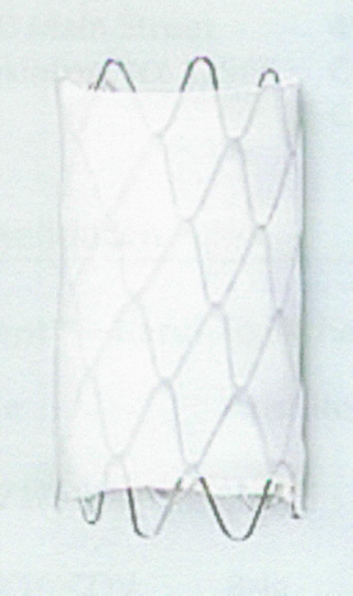 Kardiologischer Stent, sog. CP Stent, in zwei unterschiedlichen Ausführungen und in verschiedenen Längen (16, 22, 28, 34, 39 und 45 mm), im Wesentlichen bestehend aus einem röhrenförmigen Platin/Iridium-Drahtgeflecht in einem Zick-Zack-Muster mit 8 Rauten pro Segment, je nach Ausführung entweder unbeschichtet oder mit einer dehnbaren Hülle aus ePTFE überzogen. Die Kreuzpunkte des Drahtgeflechts sind mit Gold beschichtet.
Äußere Form: siehe Abbildung in der Anlage.
Der Stent wird an einem Ballonkatheter (nicht Gegenstand dieser vZTA-Entscheidung) montiert und anschließend in die Aorta vorgeschoben. Der durch den Ballon zu expandierende Stent ist zur Anwendung bei Aortenstenosen in der Kinderkardiologie vorgesehen. Die Expansion ist zwischen 12 mm und 24 mm möglich.

Die Ware wird als "Vorrichtung zum Implantieren in den menschlichen Körper, zum Beheben einesFunktionsschadens, nicht von den Unterpositionen (KN) 9021 1010 bis 9021 9010 erfasst" eingereiht.