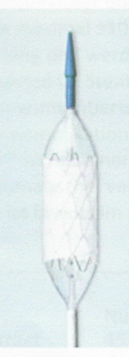 Kardiovasculärer Stent als All-In-One-Stent-System, sog. NuDEL, in Form einer zusammengesetzten Ware, im Wesentlichen bestehend aus einem gitterförmigen, den Charakter der Ware bestimmenden Platin/Iridium-Drahtgeflecht in Röhrenform (Stent-Röhrchen) mit einer dehnbaren Hülle aus ePTFE überzogen, bereits an einem 100 cm langen sog. BIB-Ballonkatheter vormontiert, in verschiedenen Stent-Längen (16, 22, 28, 30, 35, 40 und 50 mm) und Ballon-Durchmessern (12 bis 24 mm), mit enthaltener 12 F- bzw. 14 F-Schleuse.
Äußere Form: siehe Abbildung in der Anlage.
Die Ware wird in die Aorta vorgeschoben. Durch den Ballon-In-Ballon-Katheter (BIB) wird der Stent durch den inneren Ballon vordilatiert und anschließend durch den äußeren Ballon auf den gewünschten Durchmesser gebracht. Der zu expandierende Stent ist zur Anwendung bei Aortenisthmusstenosen vorgesehen. 

Die Ware wird als "Vorrichtung zum Implantieren in den menschlichen Körper, zum Beheben von Funktionsschäden, nicht von den Unterpositionen (KN) 9021 1010 bis 9021 9010 erfasst" eingereiht.
