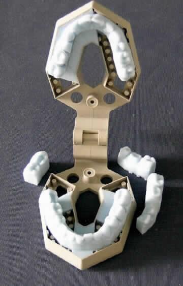 Anderes als in den Unterpositionen 9018 1100 bis 9018 4910 erfasster zahnärztlicher Apparat, sog. SLA - Model (stereolithographisches Modell) Model Kit for Chairside Oral Scanner, im Wesentlichen bestehend aus einem auf einem aufklappbaren Kunststoffträger aufgebrachten Gebissmodell aus Epoxy mit einzeln entnehmbaren Zahnmodellen. Die Ware wird zur Herstellung von zahntechnischen Restaurationen bei Einsatz einer digitalen Abformungstechnik mittels intraoral Scanner verwendet. Dabei wird die Restauration direkt auf dem Modell aus Wachs modelliert und anschließend in eine negative Form gegossen oder direkt auf Grundlage eines digitalen intraoralen Abdrucks erstellt. Das Modell dient im letztgenannten Fall dazu, das Gerüst zu verblenden. Die fertige Restauration wird auf dem Modell an den Zahnarzt verschickt, der die Eingliederung der Restauration in den Mund des Patienten vornimmt.
Ein Bild der Ware befindet sich im Internet unter http://ec.europa.eu/taxation_customs/dds/ebticau_de.htm.