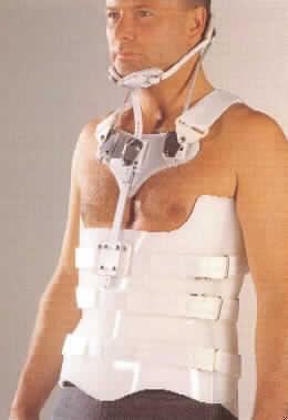 Orthopädische Vorrichtung für Menschen, sog. Modulares Rumpforthesen System (MRS), noch nicht zusammengesetzt, im Wesentlichen bestehend aus zwei mit Polyurethanschaum gepolsterten Kunststoffschalen, anatomisch geformt, für Vorder- und Rückenfront, in unterschiedlichen Höhen (TLSO HH oder Hoch, LSO), je 7 Größen für Damen und Herren, vier Vorderteil-Ausführungen (neutral, konkav, konvex oder aus Stoff), 0°- oder 12°-Lordose des Rückenteils, sowie ggfs. mit Sternalpelotte und Kopfstütze "S.O.M.I." bei Beteiligung der oberen BWS und der HWS. Die Module werden patienten- und indikationsspezifisch zusammengestellt. Die Schalen werden  vom Orthopädietechniker durch thermoplastisches Anformen, Kürzen und Perforieren individuell angepasst. Die Fixierung erfolgt durch  Klettbänder mit Metallhaken, bzw. Ösen. Das MRS wird verwendet zum Stützen und Halten der Wirbelsäule bei Osteoporose, schweren degenerativen Wirbelsäulenerkrankungen, Tumormetastasen, Osteosarkom, nach Bandscheibenoperationen, aber auch zur Stabilisierung bei Wirbelkörperfrakturen. Hauptfunktion ist das Stützen und Halten i. S. d. Anm. 6 zu Kap. 90. Die Bestandteile der Ware sind einzeln von PE-Beuteln umgeben in einem Karton verpackt. Ein Bild der Ware befindet sich im Internet unter http://ec.europa.eu/taxation_customs/dds/ebticau_de.htm
