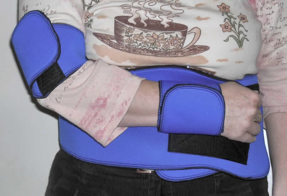 Andere konfektionierte Ware, sog. Schulterbandage "Neopren", Art. OS 102100, für
Erwachsene, siehe Foto
- bestehend aus einem bis zu 18 cm breiten und 120 cm langen Rumpfband, auf das 
  etwa 37 cm von einer Schmalseite entfernt ein etwa 39,5 cm langer und bis zu 10 cm
  breiter, knochenförmiger Zuschnitt in Art einer Oberarmmanschette aufgenäht ist und aus
  einer etwa 29 cm langen und 10 cm breiten Handgelenkmanschette,
- aus einem etwa 7 mm dicken, dreilagigen Flächenerzeugnis mit einer Außenlage aus 
  einem glatten Gewirke der Position 6002 aus Spinnstoffen, einer Zwischenlage aus 
  Zellkautschuk (sog. Neopren) und einer Innenlage aus einem Schlingengewirken der 
  Position 6001 aus Spinnstoffen (damit keine Meterware der Position 5906),
- die Gewirke sind im Hinblick auf die Verwendung und das äußere Erscheinungsbild als
  charakterbestimmend anzusehen,  
- an den Schmalseite des Rumpfbandes und der Oberarmmanschette mit aufgenähten 
  Hakenbändern (zur Befestigung an den Schlingengewirken/Klettverschluss) versehen,
- an der Handgelenkmanschette mit einem an einer Schmalseite aufgenähten Hakenband,
  mittig mit einem aufgenähten Flauschband zur Befestigung am Rumpfband,
- durch Zusammennähen konfektioniert,
- soll lt. beigefügtem Datenblatt u.a. bei Schulterluxation oder Verletzungen des 
  Oberarmkopfes verwendet werden, dient zur Stabilisierung oder Ruhigstellung des Armes  
  oder der Schulter des Patienten, in dem der Arm am Oberkörper fixiert wird, 
- nach Materialbeschaffenheit und Ausstattung keine orthopädische Vorrichtung der
  Position 9021, da die Ware lediglich für eine Teilimmobilisierung geeignet ist, es ist nicht
  möglich die verletzte oder operierte Schulter des Patienten mit der Bandage vollständig
  stillzulegen bzw. ruhigzustellen.