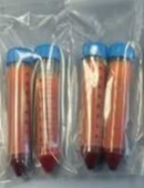 Tejido adiposo subdérmico de origen humano conservado en gentamicina obtenido por liposucción de caderas y abdomen de mujeres donantes sanas. El lipoaspirado se transporta en tubos cónicos estériles con cierre hermético en un kit de transporte en condiciones controladas, a una temperatura entre 2°C a 8ºC, y protegido de luz cuyo volumen es de 50 ml. Producto perecedero con vida útil de 48 horas. Se presenta al por menor. Cada tubo viene etiquetado con número de lote, día de la cirugía y volumen.
Preparación a base de un lipoaspirado que se utiliza para la fabricación de medicamentos.