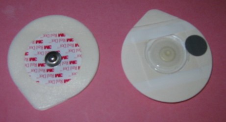 MONITORING ELECTRODES WITH FOAM BACKING AND STICKY GEL FOR CONDUCTIVE PURPOSES. THEY ARE USED WHEN A PATIENT HAS AN ELECTROCARDIOGRAPH. THE ELECTRODES ARE PLACED ON THE CHEST AND THE ECG WIRES ARE CONNECTED TO THE SKIN BY AN ALLIGATOR CLIP.