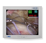 Kolorowy monitor LCD o przekątnej ekranu 15 – 55", przeznaczony do bezpośredniego wyświetlania obrazów (zdjęć lub wideo) z medycznych urządzeń endoskopowych lub radiologicznych. Przystosowany jest również do współpracy z maszynami do automatycznego przetwarzania danych. Opcjonalnie wyposażony w panel dotykowy. Obudowa wykonana została z tworzywa sztucznego. Przyciski umieszczone w przednim panelu monitora pozwalają na regulację parametrów wyświetlania i wybranie źródła sygnału. Złącza: DVI, Video, VGA S-VHS. Według oświadczenia Wnioskodawcy - monitor nie posiada wbudowanego tunera telewizyjnego, głośników, odbiornika podczerwieni czy przycisków zmiany kanałów.

WIT wydana powtórnie w miejsce decyzji nr PL-WIT-2015-01251 z dnia 14.08.2015 r.