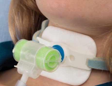 Dihalni pripomoček imenovan »umetni nos« izdelan iz plastične mase v obliki valjastega ohišja s priklopom za trahealno cev (Ø 15 mm) in priključkom za dovod kisika. V notranjosti se nahaja plastična celičasta spužva. Na sprednji strani se nahaja pokrov, ki je namenjen za izsesavanje vode iz pljuč in se tudi se pri povečanemu izdihu (npr. kašelj) odpre.
Namesti se ga na bolnikovo trahealno cev (dolgotrajna uporaba) in vzdržuje primerno vlago ter temperaturo vdihanega zraka skozi traheostomo (HME - Heat and Moisture Exchanger).
Sestava: polivinilklorid (PVC), polietilen (HDPE), poliuretanska pena
